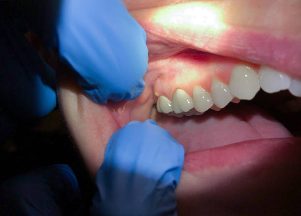 Dentist for Dental Trauma in KS