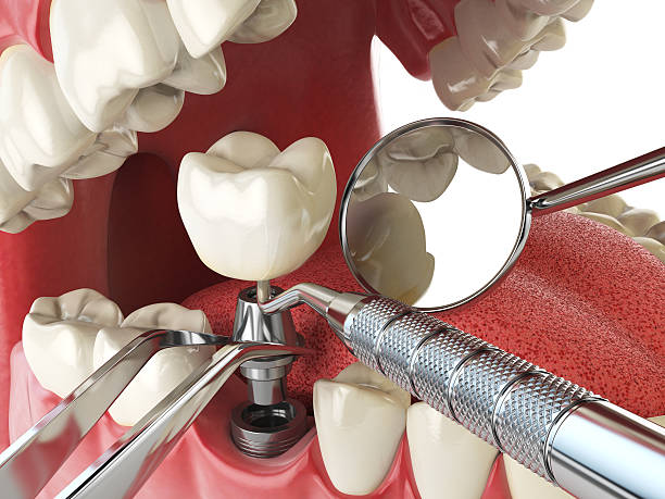 Best Emergency Gum Pain Relief  in Atchison, KS