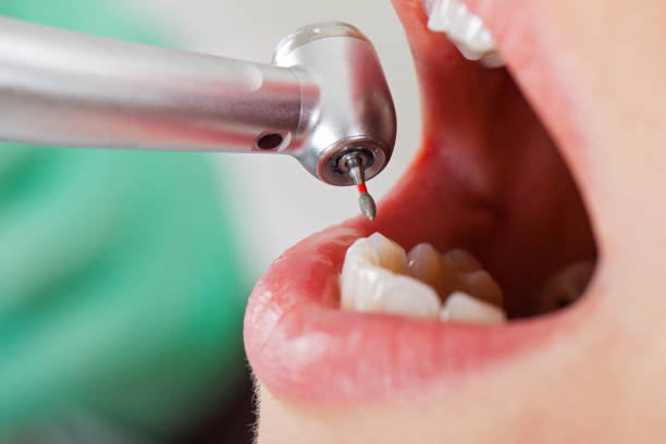 Best Teeth Whitening  in Atchison, KS